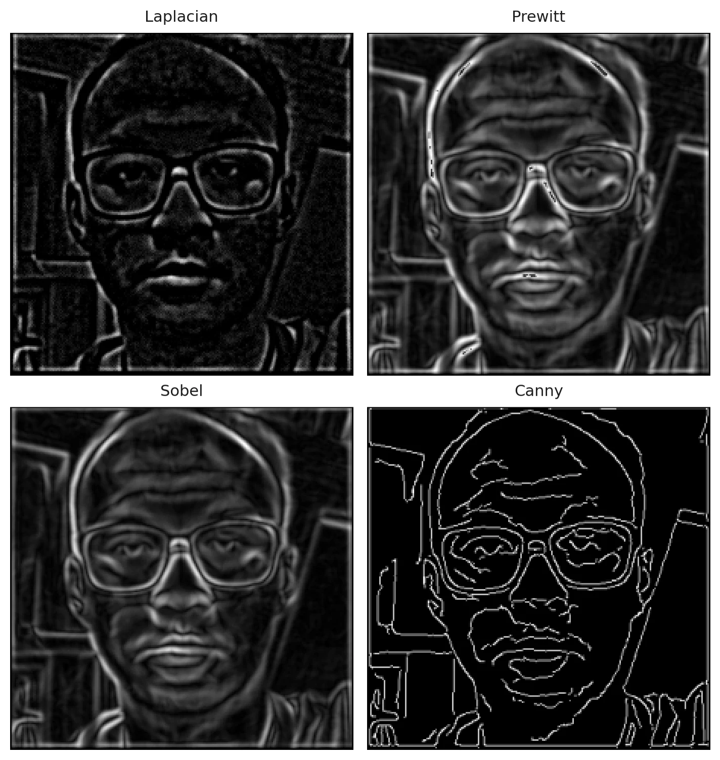 Four-panel comparison of Laplacian, Prewitt, Sobel and Canny edge detection on the same face
